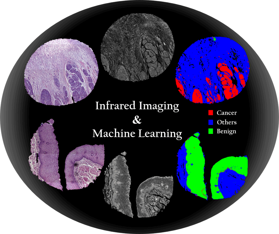 graphic of inrared imaging and machine learning description below