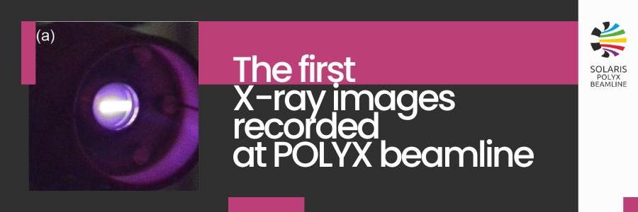 The first X-ray images recorded at POLYX beamline